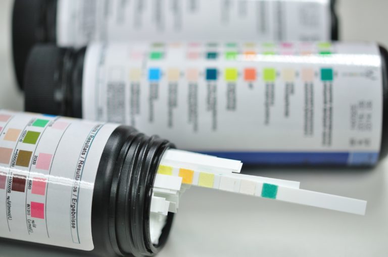 Understanding What Are Drug Test Kits and How They Work