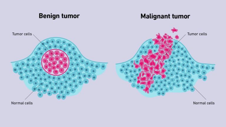 Definition of Malignancy - Is it a Cancer?