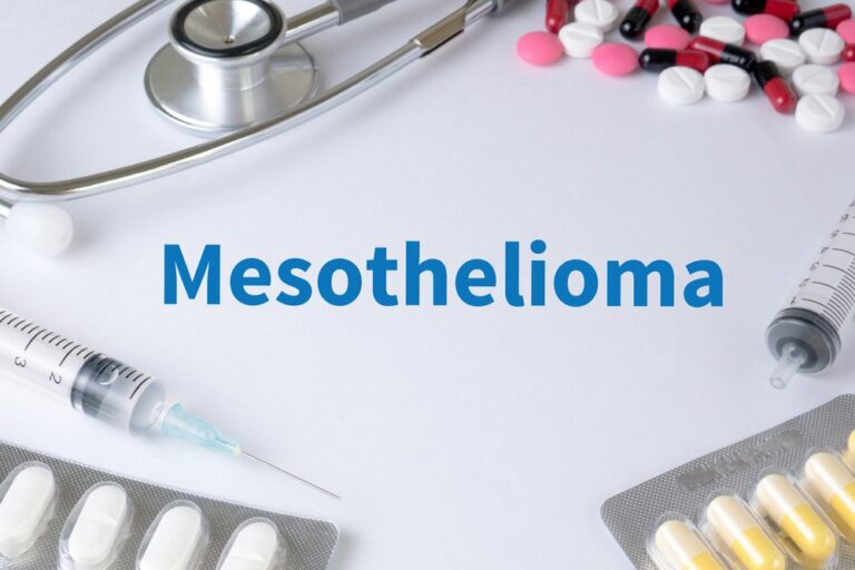 Mesothelioma Life Expectancy After Diagnosis