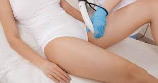Potential Side Effects of Laser Hair Removal on the Private Parts